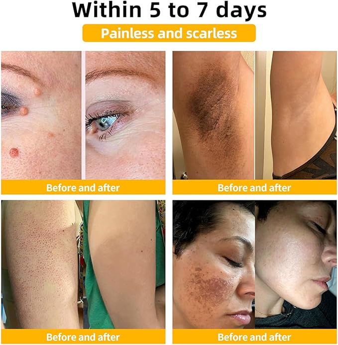 BGOS™ BEE VENOM SKIN TREATMENT CREAM,REPAIR MAXIMUM STRENGTH FOR ALL SKIN TYPES (BUY 1 &, GET 1 FREE - 2PCS)