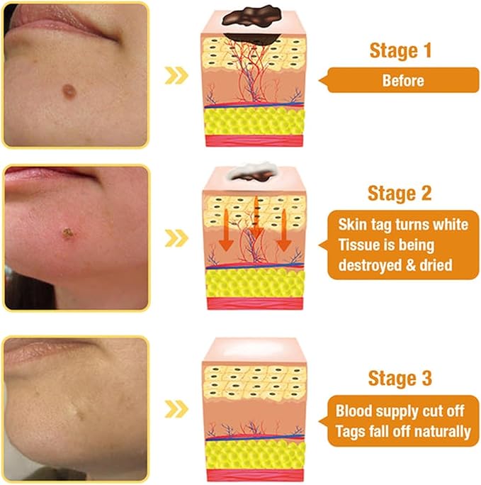 BGOS™ BEE VENOM SKIN TREATMENT CREAM,REPAIR MAXIMUM STRENGTH FOR ALL SKIN TYPES (BUY 1 &, GET 1 FREE - 2PCS)