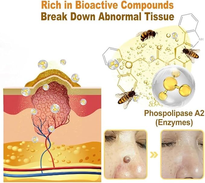 BGOS™ BEE VENOM SKIN TREATMENT CREAM,REPAIR MAXIMUM STRENGTH FOR ALL SKIN TYPES (BUY 1 &, GET 1 FREE - 2PCS)